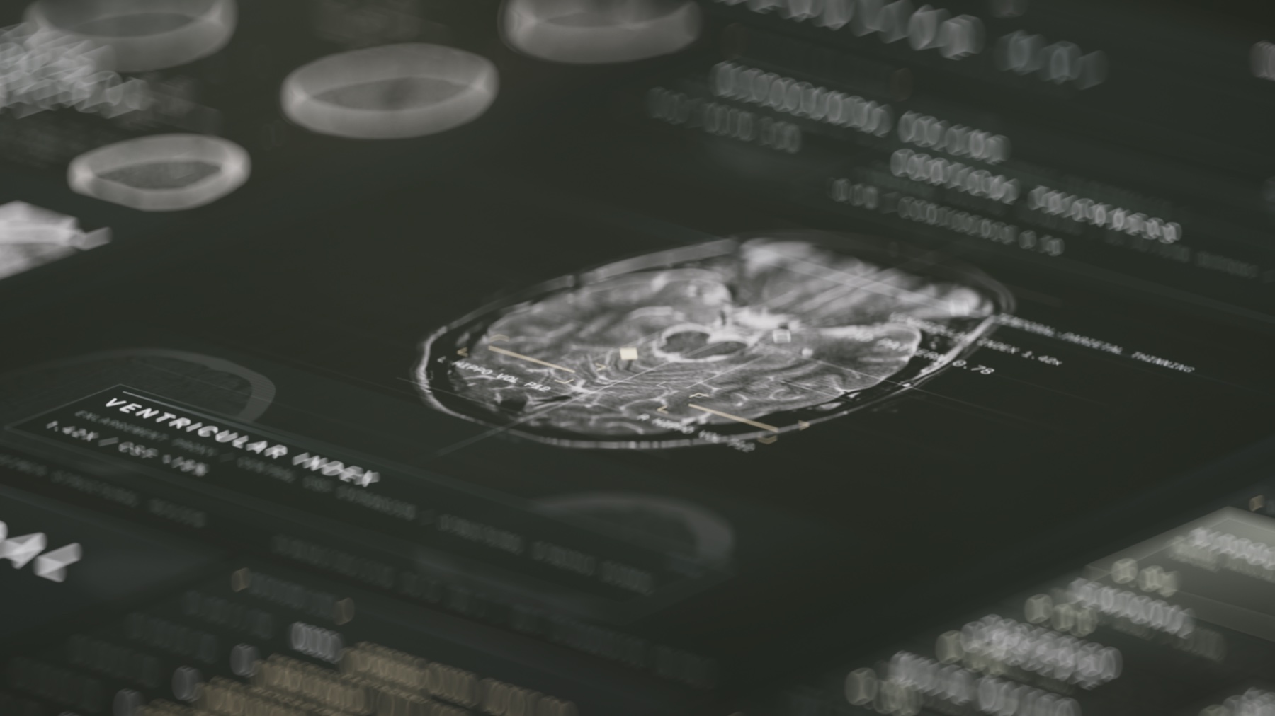 Neurodegenerative Alzheimer MRI review interface artwork