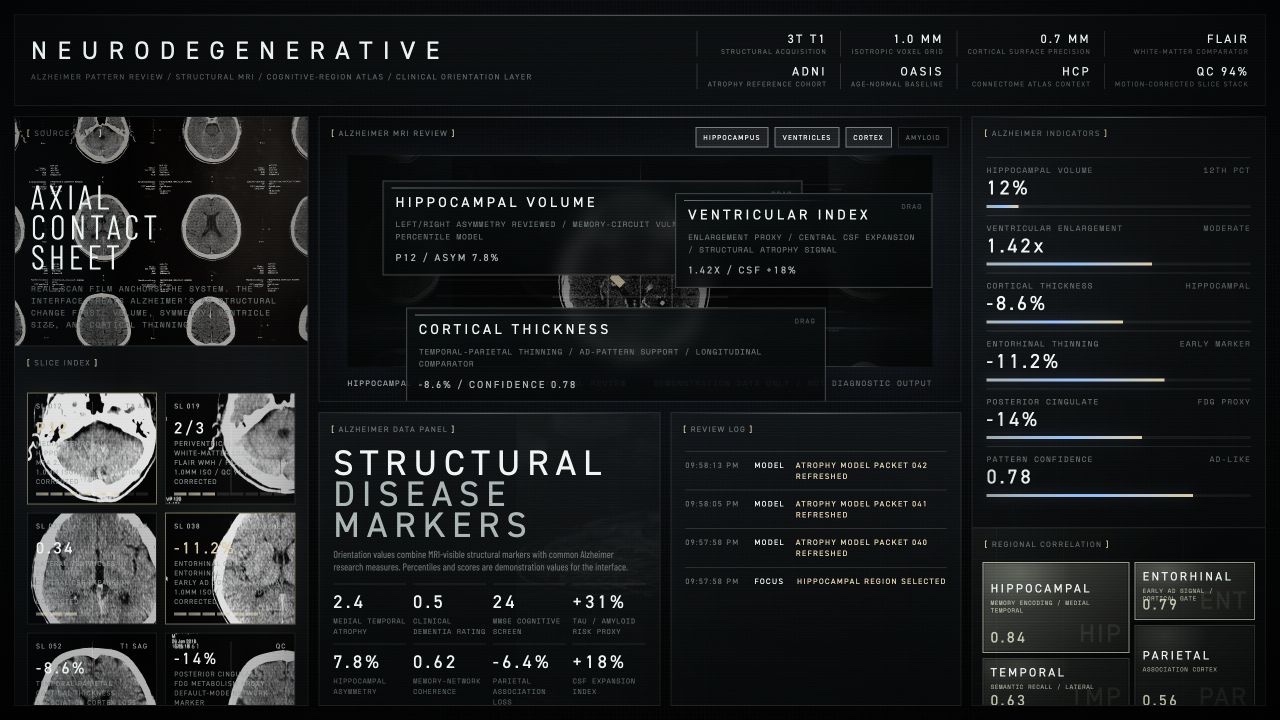 Alzheimer structural MRI review dashboard with axial contact sheet and regional indicators